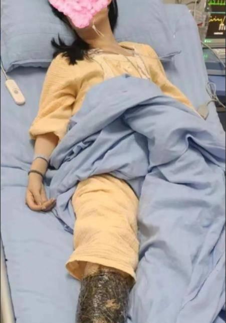 动物被蛇咬会带来哪些后果？（蛇咬动物的影响及应对措施）